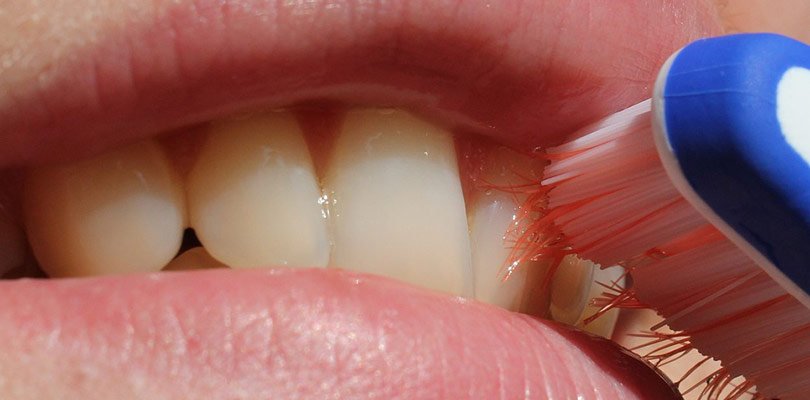 Diş apsesi nasıl patlatılır